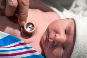 cardiopathie- congénitale