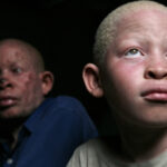 Un albinos et son père à Dar Es Salaam en Tanzanie. Photo: Panos/ Dieter Telemans