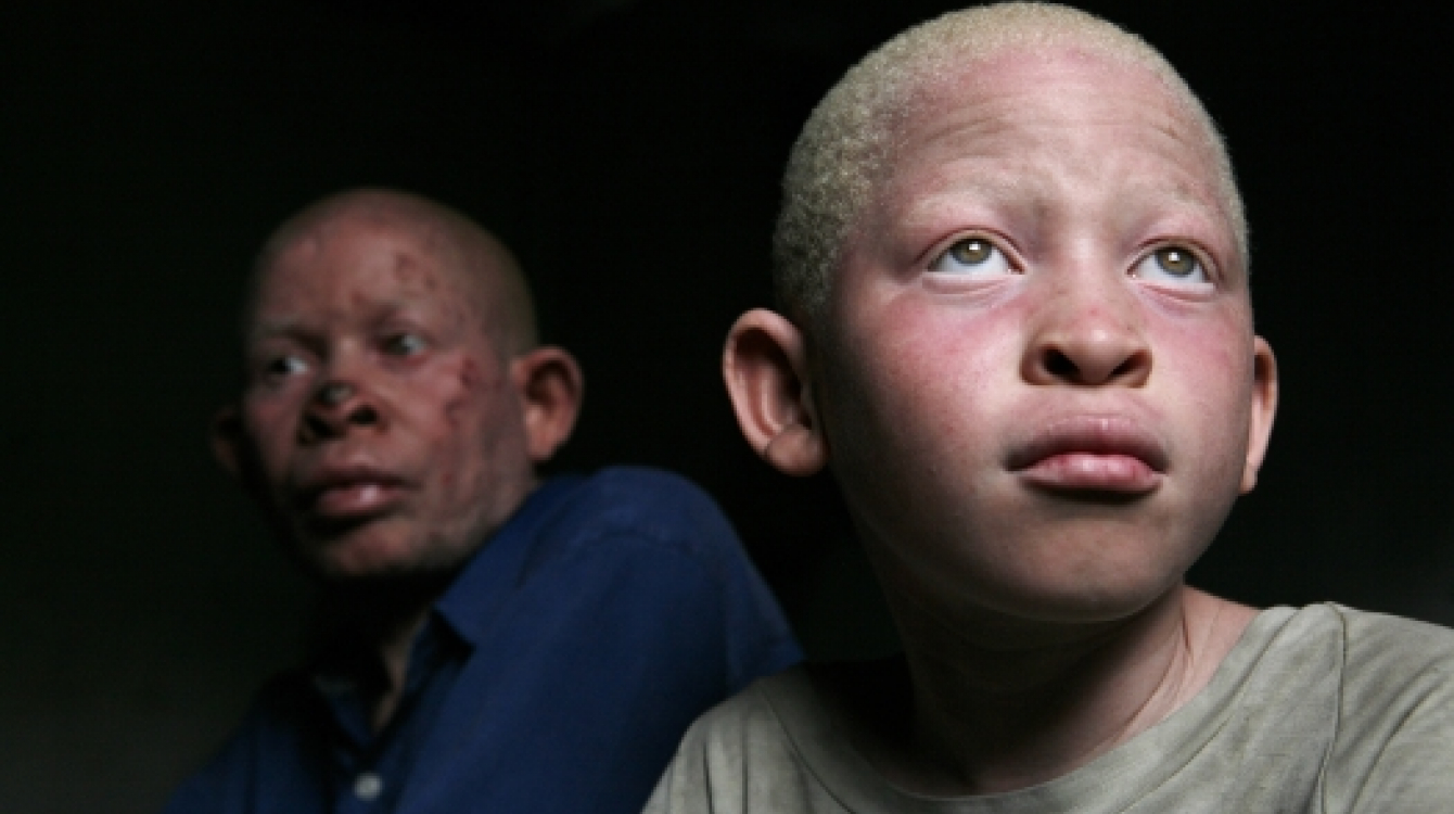Un albinos et son père à Dar Es Salaam en Tanzanie. Photo: Panos/ Dieter Telemans