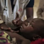 ROUGEOLE L’épidémie de rougeole continue de sévir dans la province du Sud-Kivu