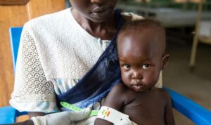 Kwashiorkor au Soudan du Sud